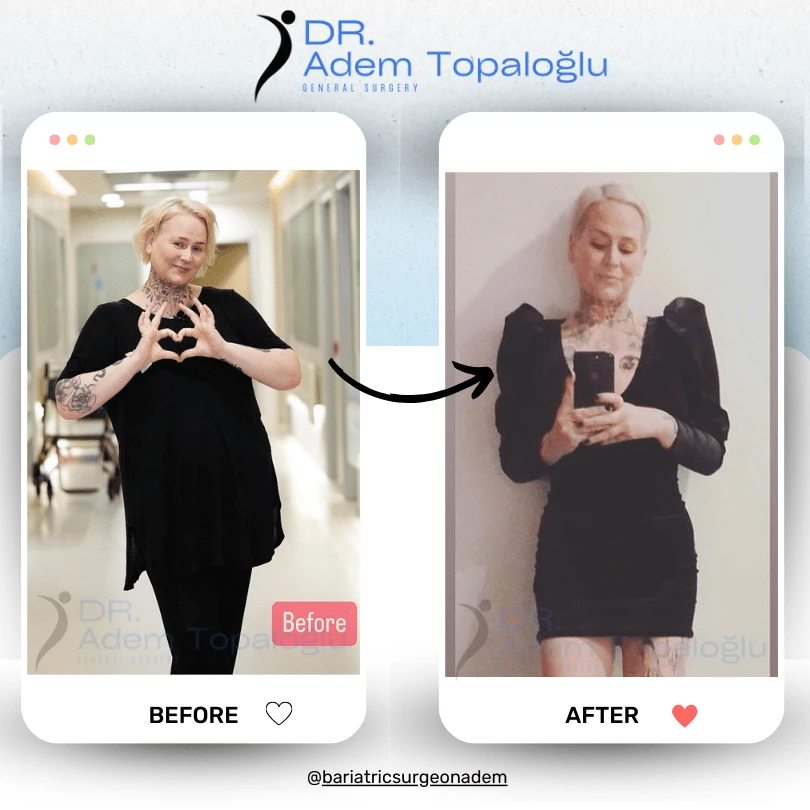 drademtopalogluBeige Minimalist Before and After Makeup Transformation Instagram Post (1)